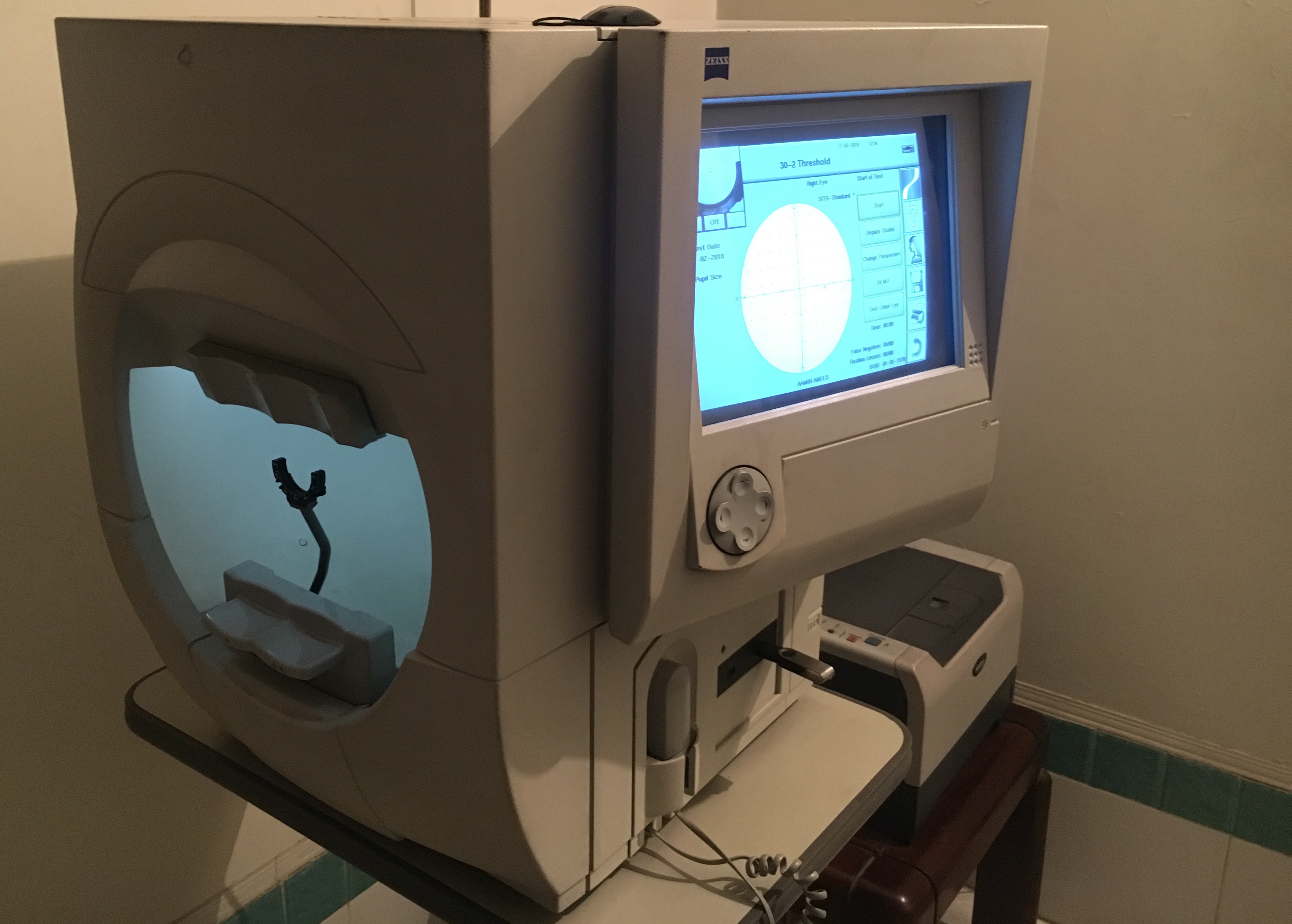GLAUCOMA SERVICE